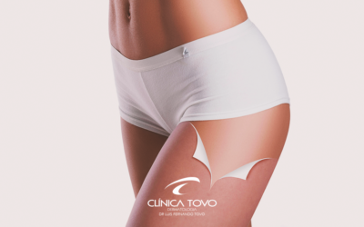 Existe Solução para Celulite? – Reportagem do Fantástico