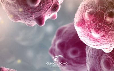 Câncer da Pele – II Simpósio Internacional de Oncologia Cutânea – Hospital Sírio Libanês – 05 à 06 de Abril 2018