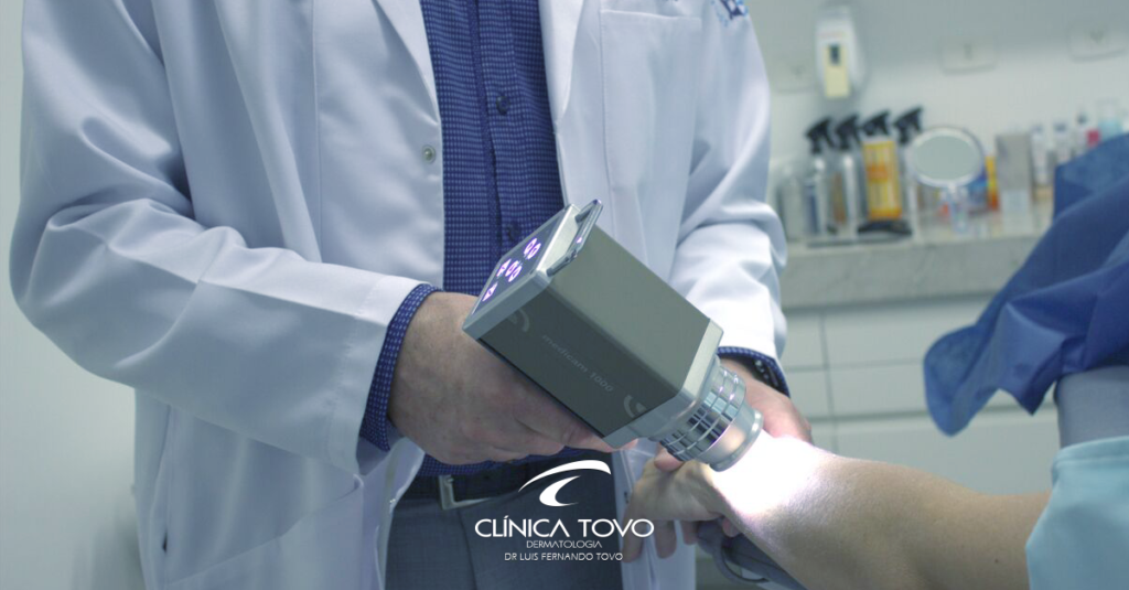 dermatoscopia digital e mapeamento corporal