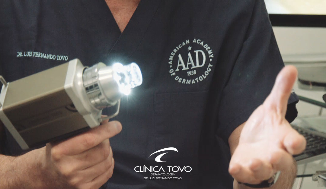 Clinica Tovo Luis Fernando Tovo – Dr Tovo fala sobre dermatoscopia digital