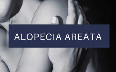 ALOPECIA AREATA
