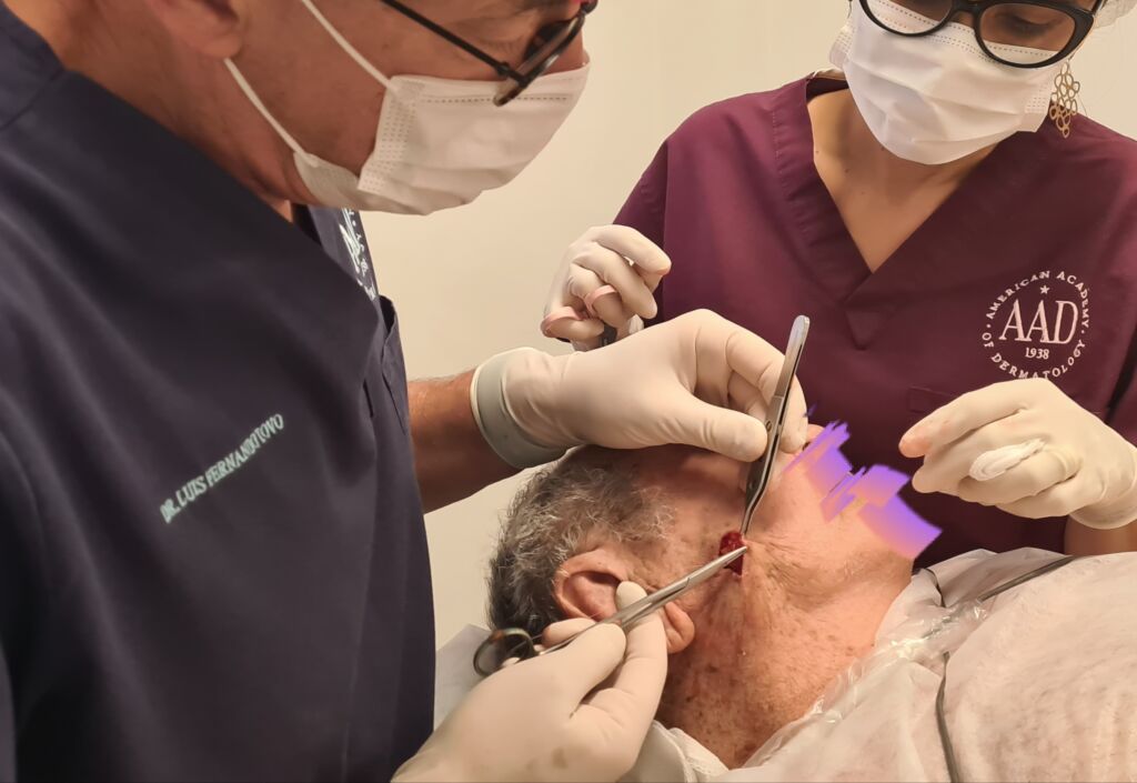 câncer da pele tratamento cirúrgico dr tovo luis fernando tovo clinica tovo dermatologia