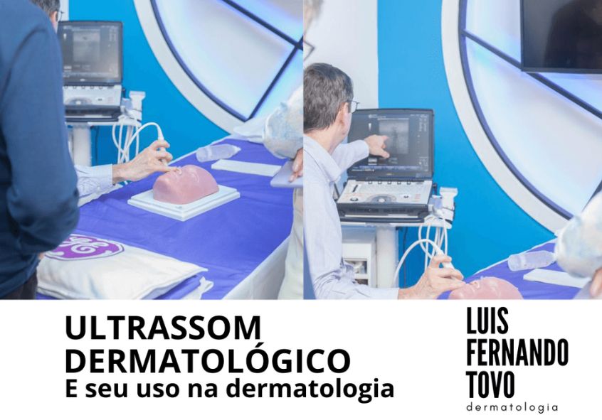 Ultrassom Dermatológico | seu uso na dermatologia