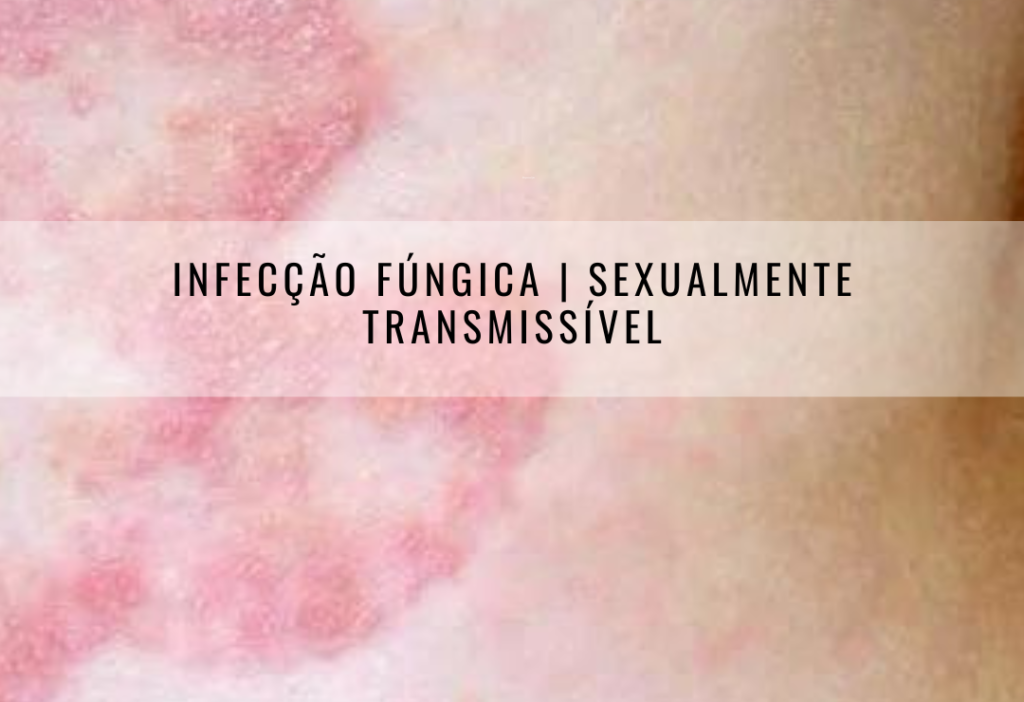 infecçao fungica